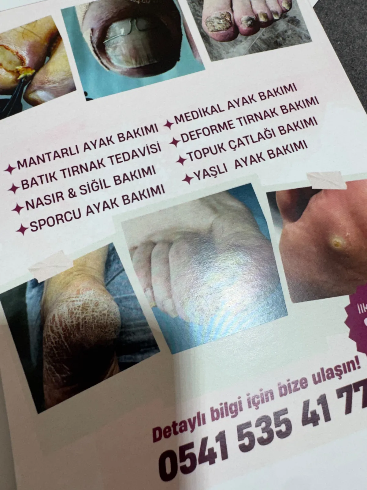 Gerçek Baskı Fotoğrafı 12